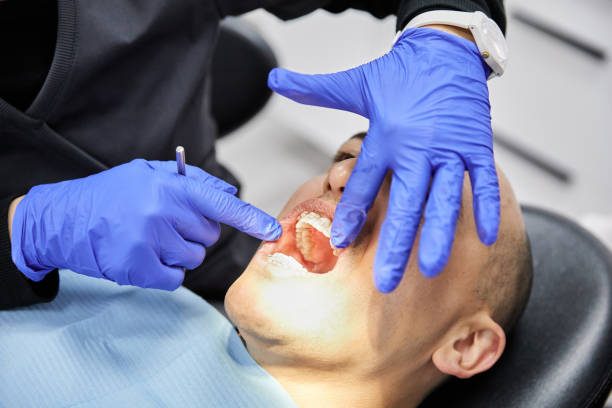 Best Chipped Tooth Repair Near Me  in Pueblo West, CO